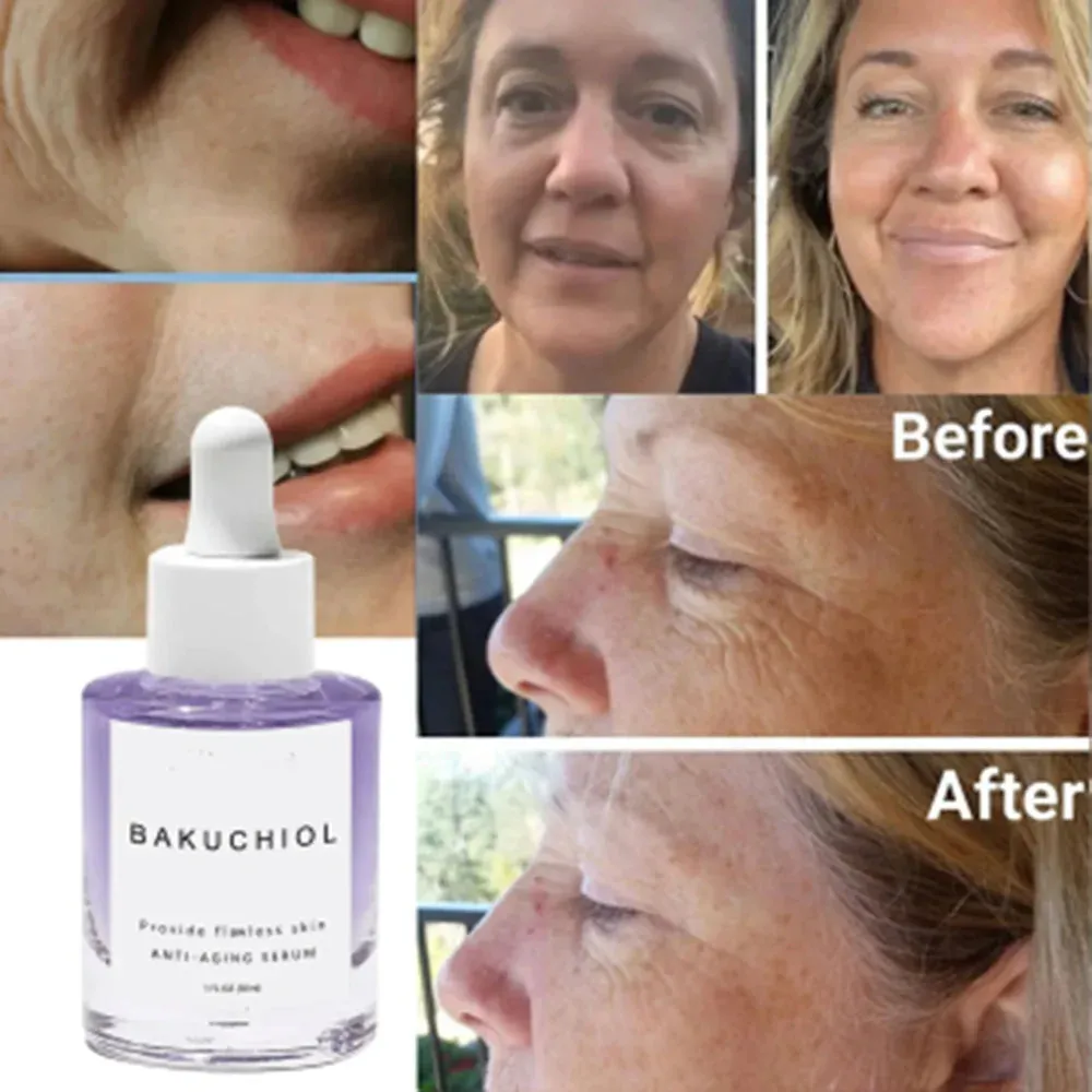 Bakuchiol Face Serum