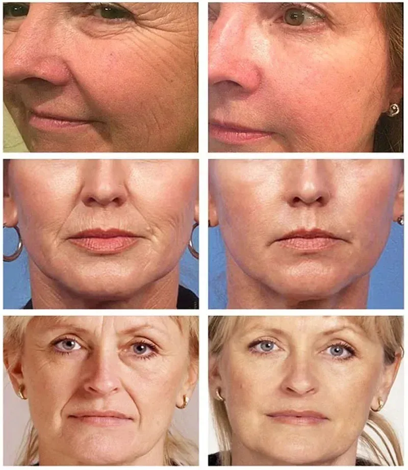 Bakuchiol Face Serum