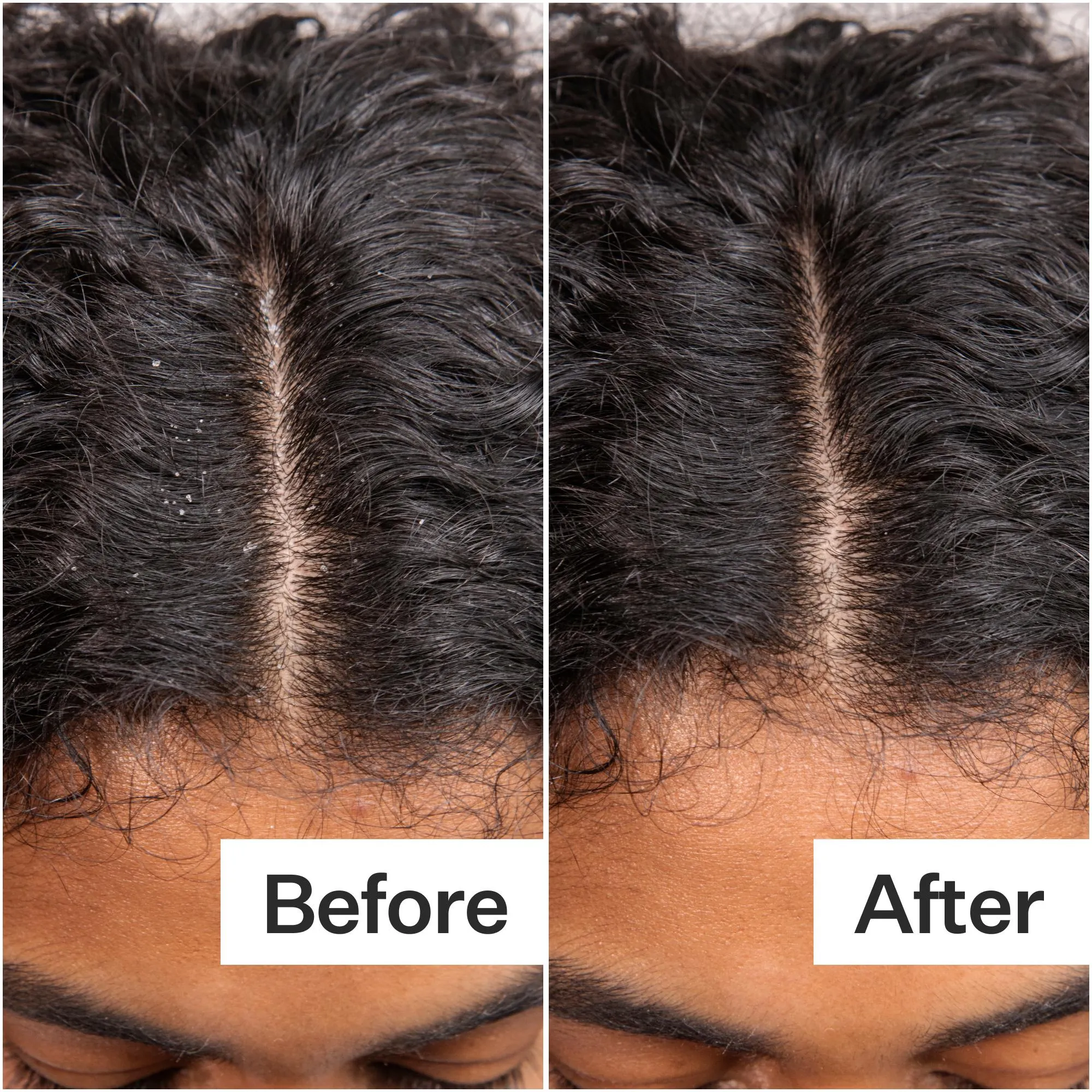 Daily Hydro™ Scalp Serum 3-Pack