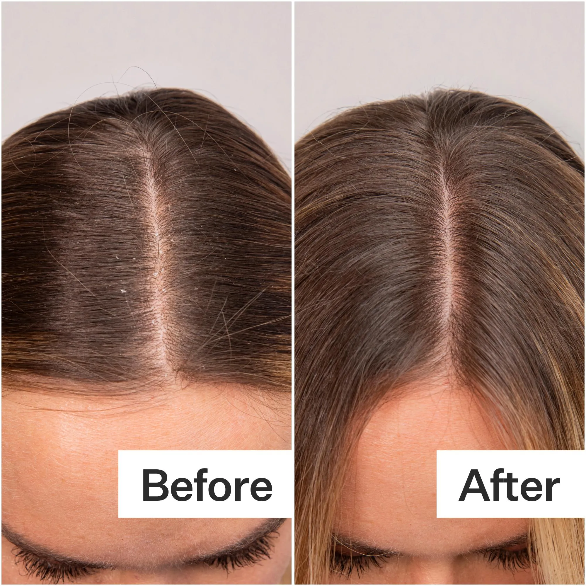 Daily Hydro™ Scalp Serum 3-Pack