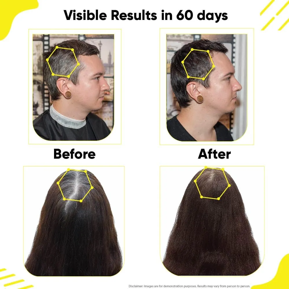Hair Darkening Serum with Anti Greying Arcolys & Melano Gray ( Pack of 1 )