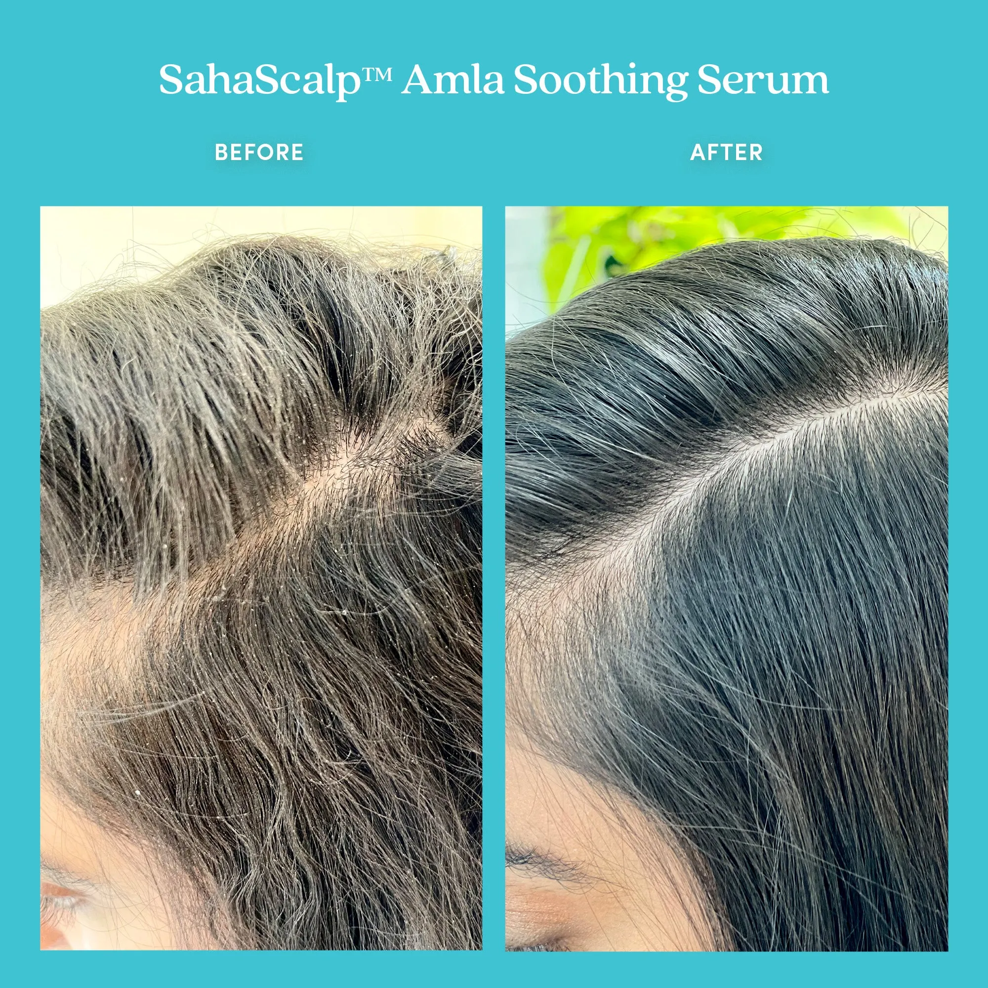 Healthy Hair Oiling Ritual