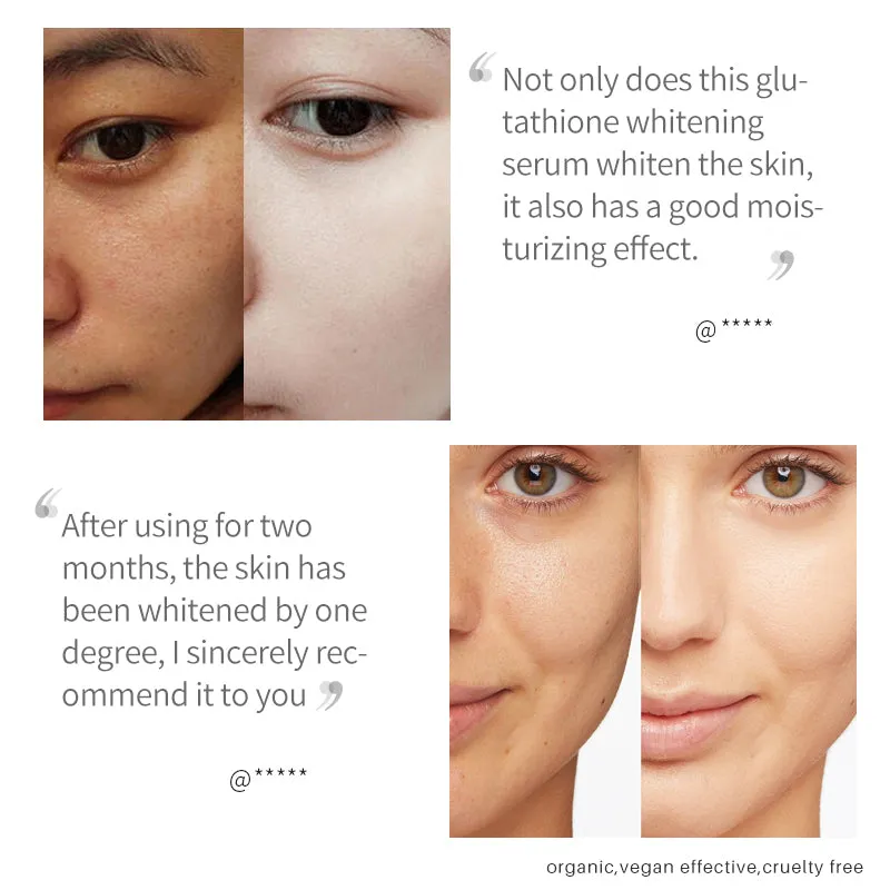 Lanthome Hyaluronic Glutathione and Vitamin C Face Serum – Skin Whitening Glutathione Serum