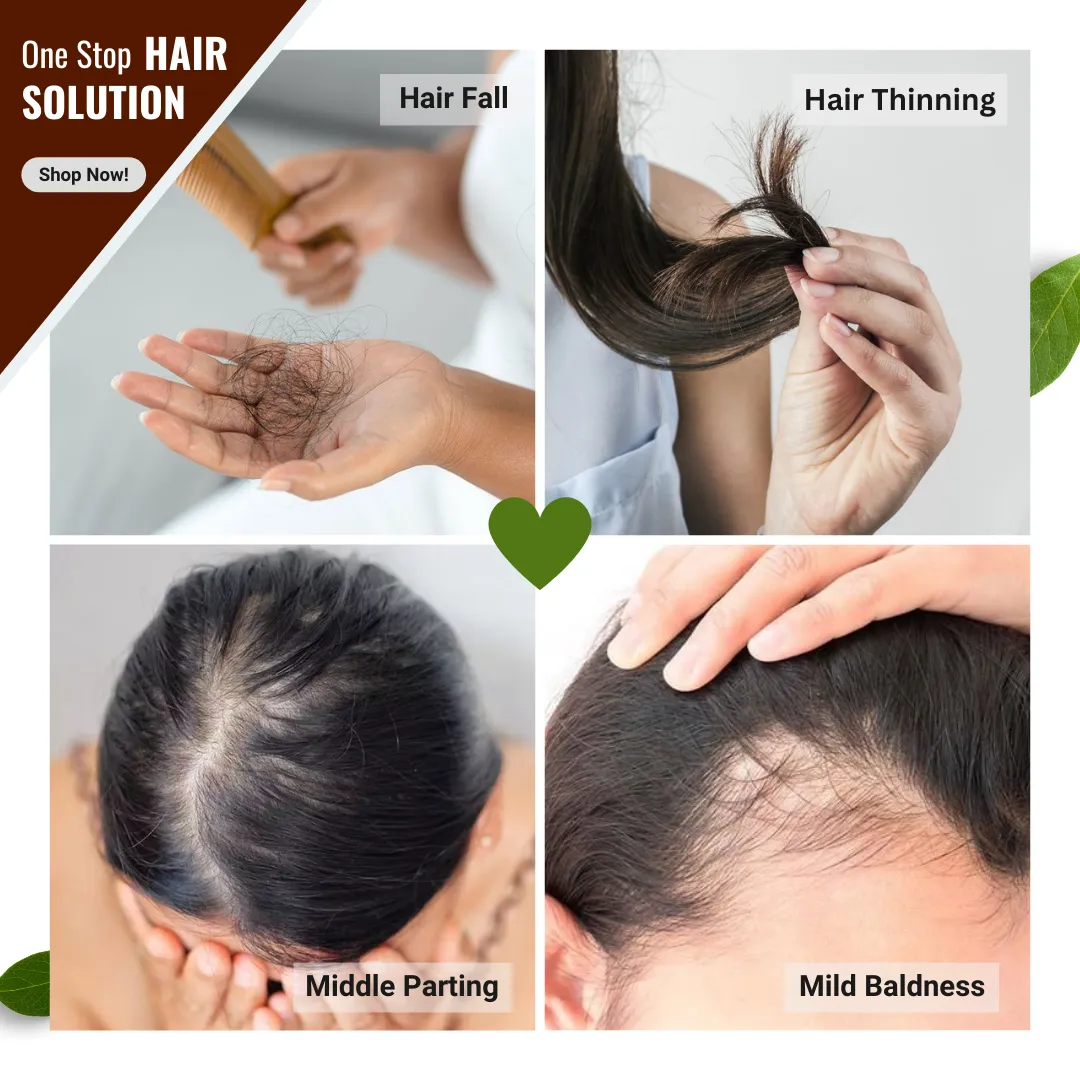 Natural Infusions Hair Growth Serum (50ml) | Redensyl, Anagain, Rosemary, Procapil, & Capila Longa | Controls Hair Fall | Increase Hair Density | For Men and Women