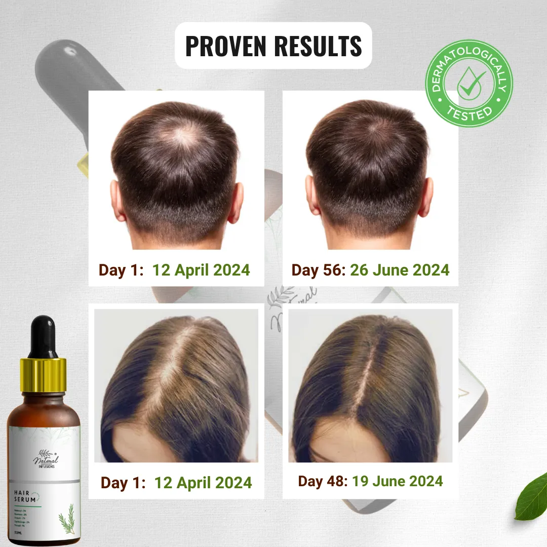 Natural Infusions Hair Growth Serum (50ml) | Redensyl, Anagain, Rosemary, Procapil, & Capila Longa | Controls Hair Fall | Increase Hair Density | For Men and Women