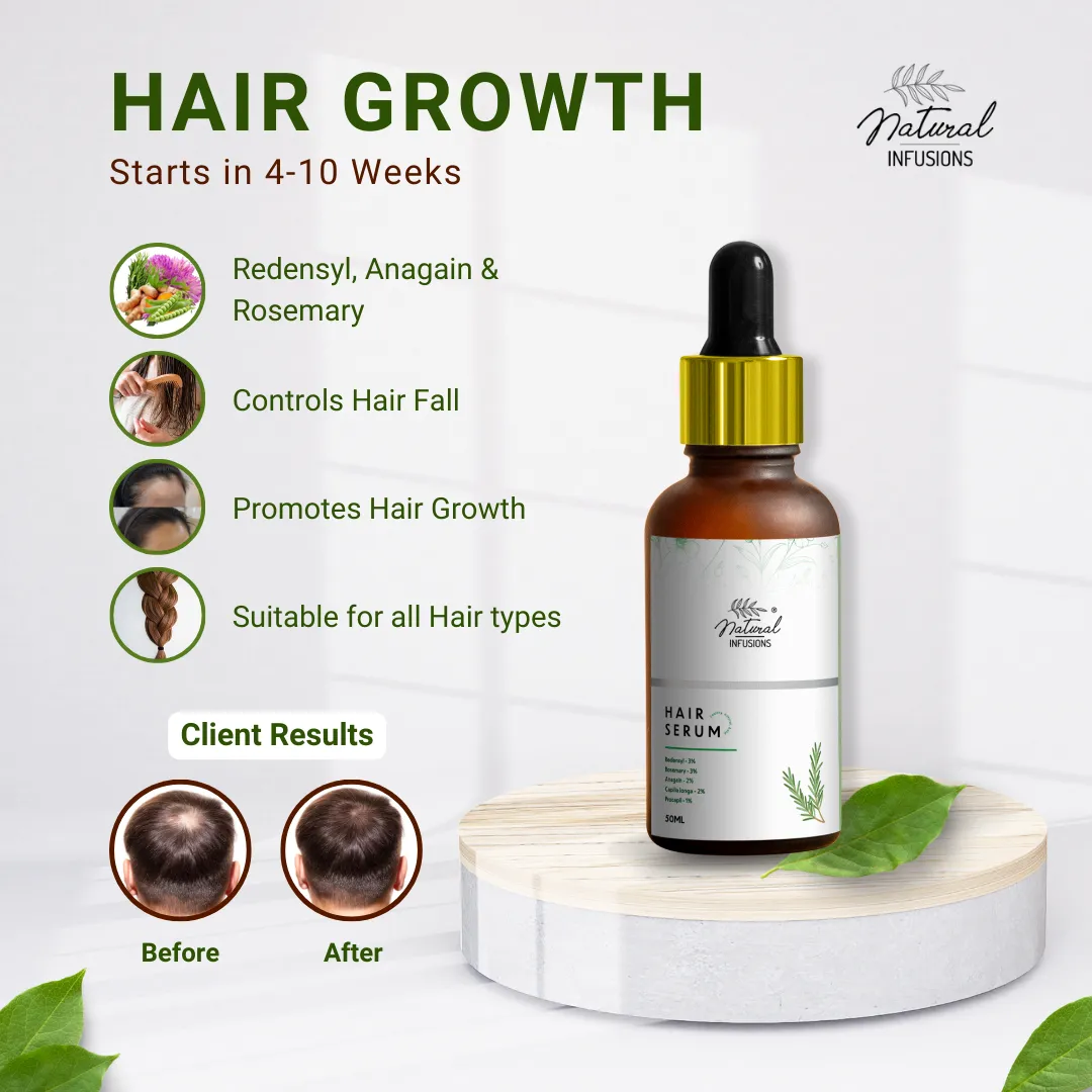 Natural Infusions Hair Growth Serum (50ml) | Redensyl, Anagain, Rosemary, Procapil, & Capila Longa | Controls Hair Fall | Increase Hair Density | For Men and Women