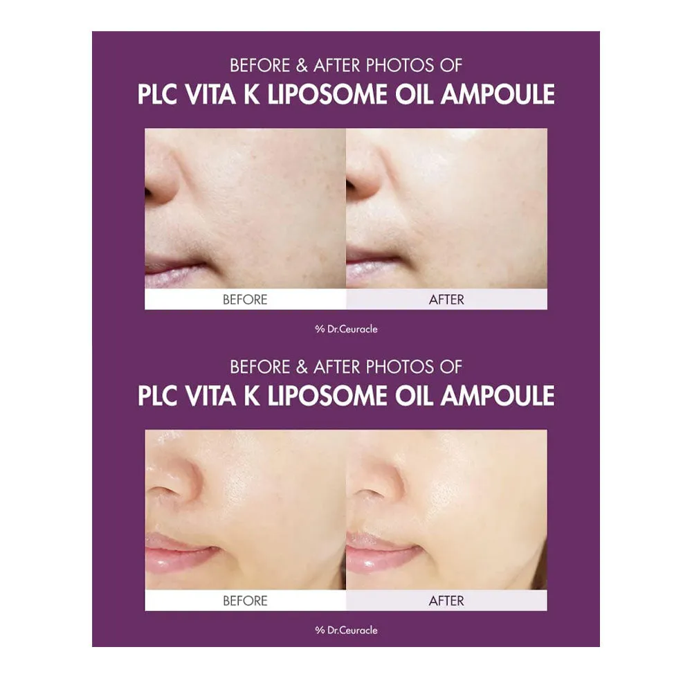 PLC Vita K Liposome Oil Ampoule