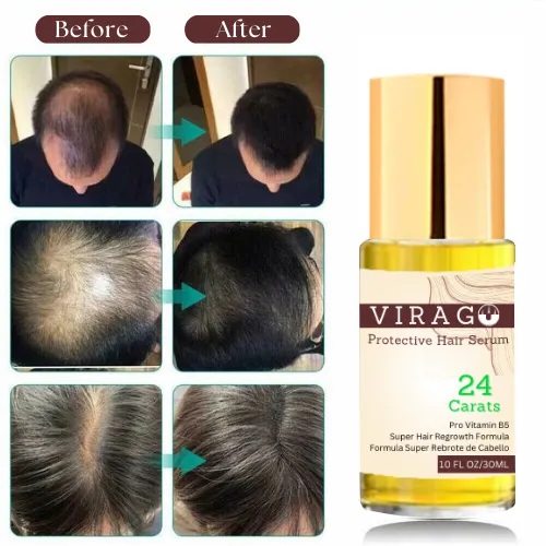 Virago Hair Serum - Anti Hair Loss & Hair Growth Serum